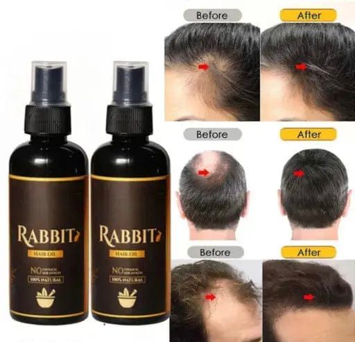Garuda Rabbit Herbal Hair Oil 300ML– 100% Stronger, Healthier Growthh
